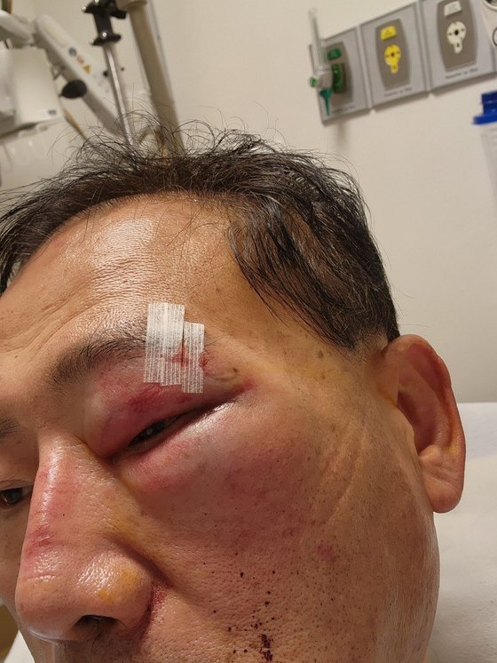 괴한에게 폭행당한 정용우씨. [본인 제공]