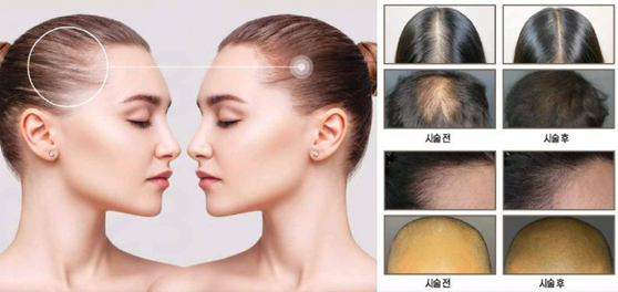 아이러브뷰티