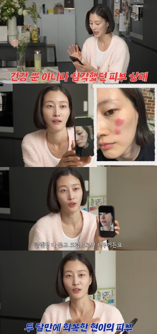 [사진]OSEN DB.