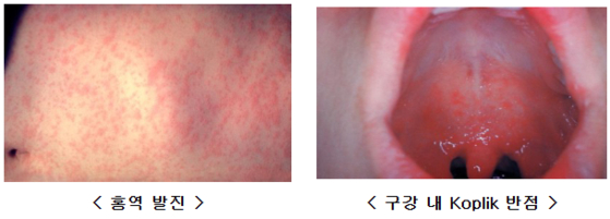 미국질병관리본부,질병관리청