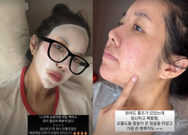[사진]OSEN DB.