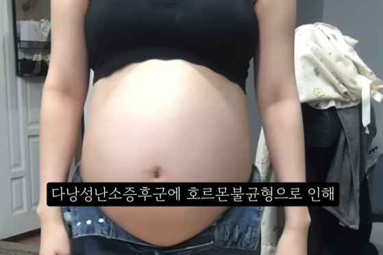 '36주 낙태' 경험담을 담은 영상 장면. 사진 유튜브 캡처