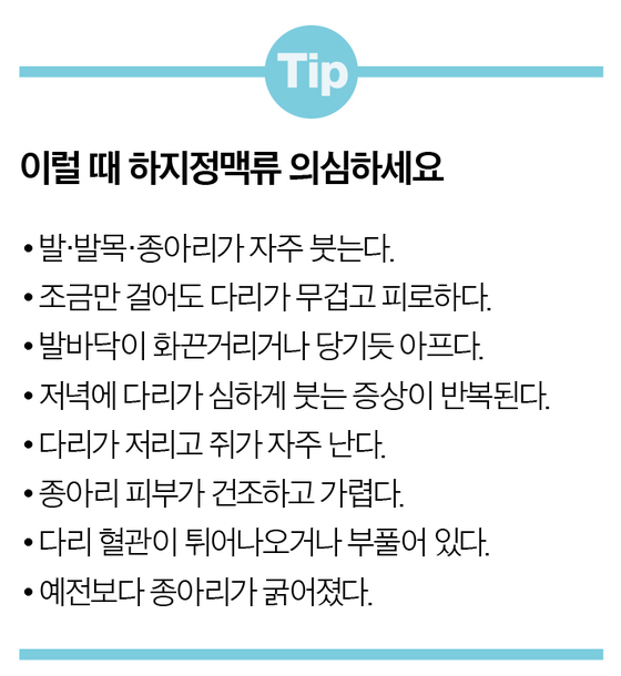 하지정맥류