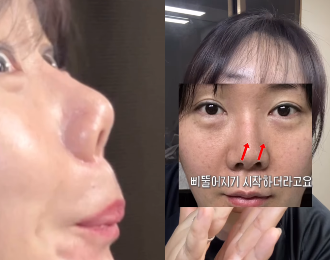 [사진]OSEN DB.