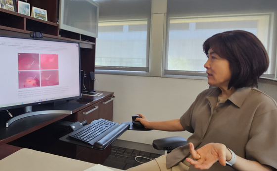 지난달 11일 미국 오하이주 콜럼버스시 오하이오주립대에서 만난 이지영 보건학 교수가 마이크로시스틴과 간암의 연관성 연구에 대해 설명하고 있다. 콜럼버스=정은혜 기자 