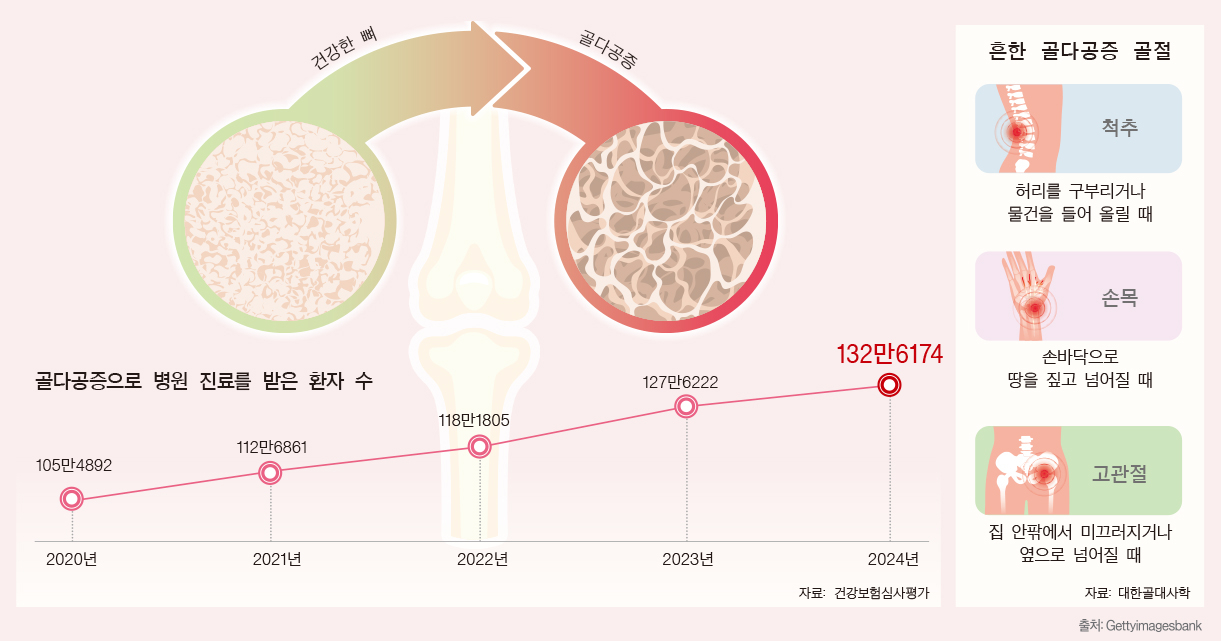 나이 들수록 뼈의 양이 줄고 뼈가 약해지면서 골다공증 발생 위험이 높아질 수 있어 주의해야 한다. [출처: Gettyimagesbank]