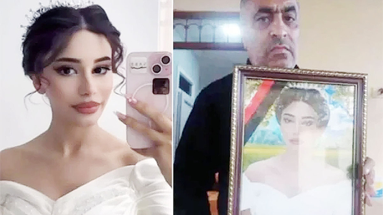 아제르바이잔의 레만 맘마들리(19)는 어깨가 드러나는 드레스를 입고 결혼식을 진행했다가 신랑측 가족들의 비난을 받고 다음날 극단적 선택을 했다. 데일리메일