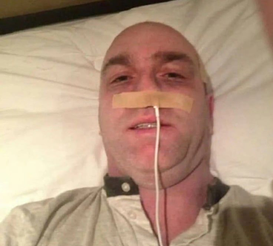 데니스 조셉 케리가 콧구멍에 아이폰 충전기를 꽂은 모습. 사진 더선 캡처