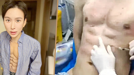 인공 복근을 위해 8억여 원을 들인 중국 남성 앤디 하오 티엔난의 모습 사진 SCMP 캡처