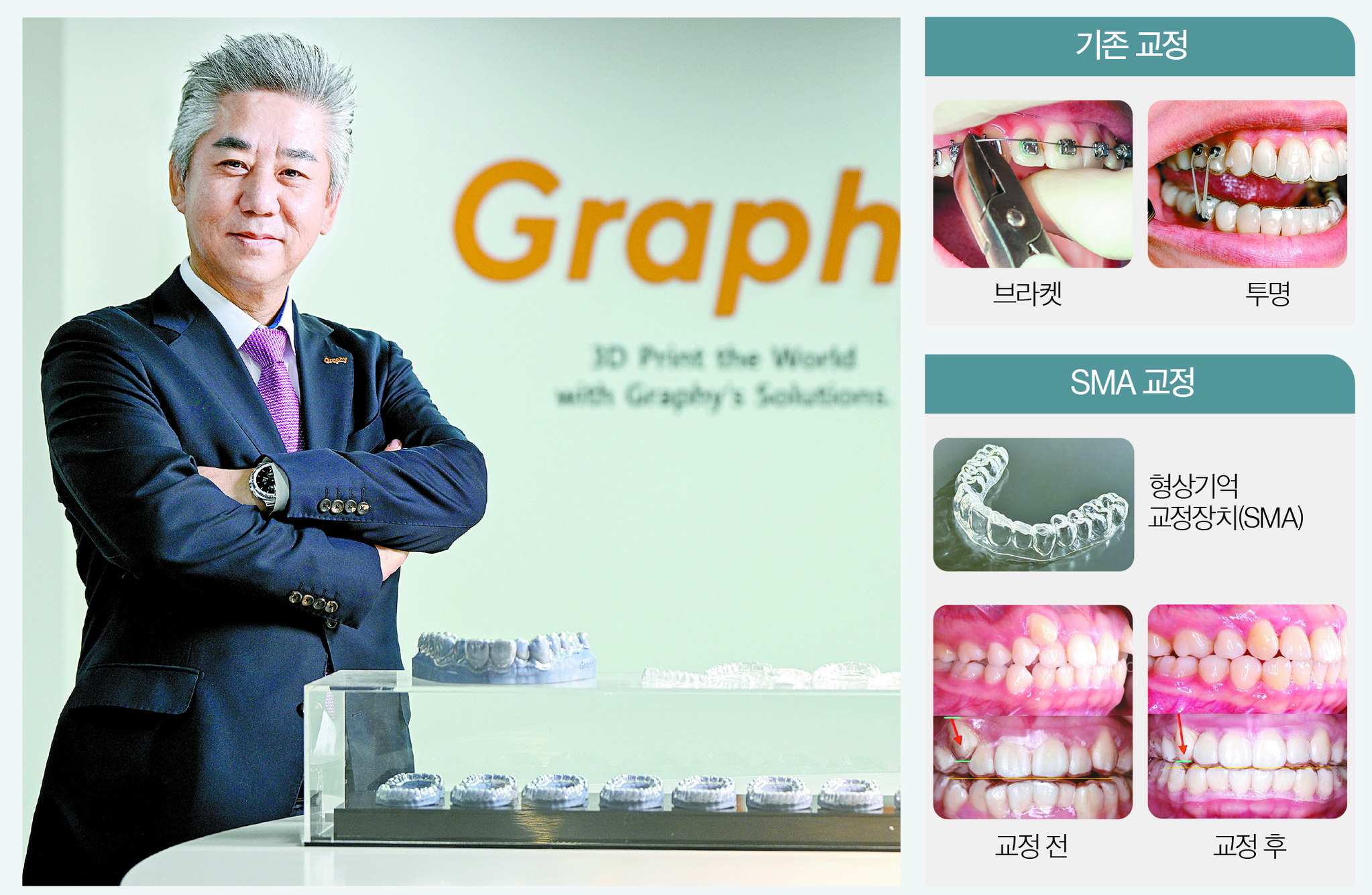 심운섭 그래피 대표는 “SMA는 환자와 치과의사 모두의 시간을 가치 있게 만드는 기술”이라고 말했다. 김동하 객원기자