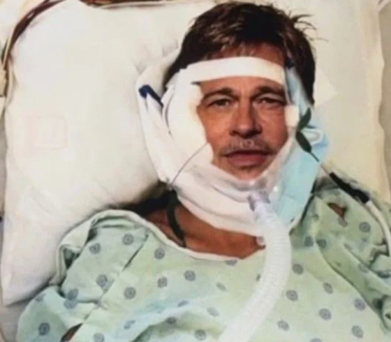 사칭범이 치료비를 요구하며 보내 온 브래드피트의 AI 합성 사진. X 캡처