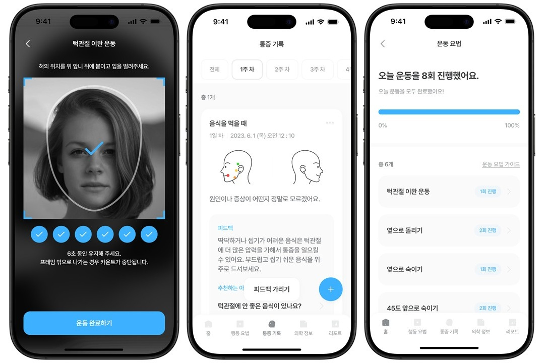 턱관절장애 디지털 치료제 사용 모습. 사진 한림대의료원