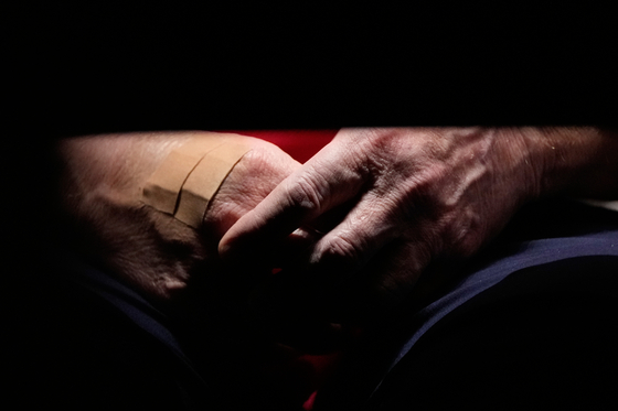 도널드 트럼프 미국 대통령이 2일(현지시간) 백악관에서 진행한 각료회의에서 손에 반창고를 붙이고 있는 장면이 포착됐다. AP=연합뉴스