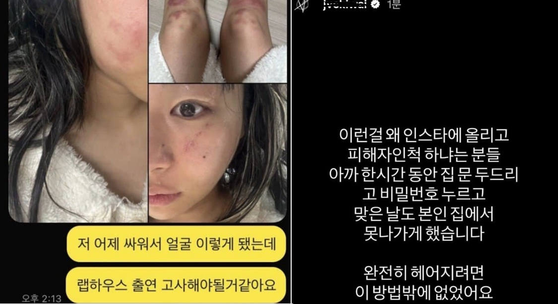 사진 인터넷 캡처