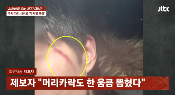 JTBC 사건반장 캡처