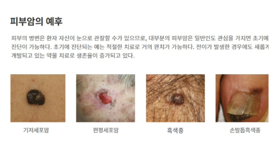 서울대학교 암연구소 홈페이지 캡처.