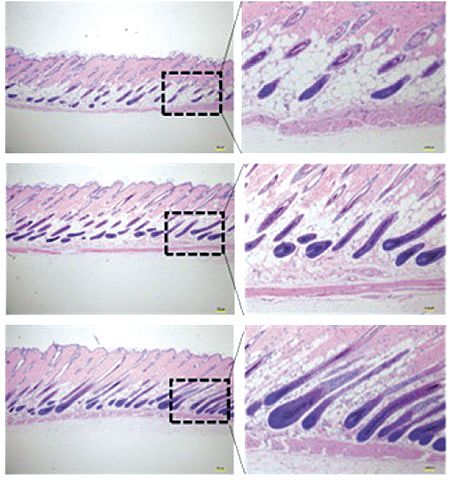 위 사진부터 대조군, 모발유산균(LB-P9) 저용량군, 모발유산균(LB-P9) 고용량군의 피부 세로 단면. 확대한 오른쪽 사진을 보면 고용량일수록 털이 굵고 건강한 형태를 띤다. 자료=Food Science and Animal Resources(2024)