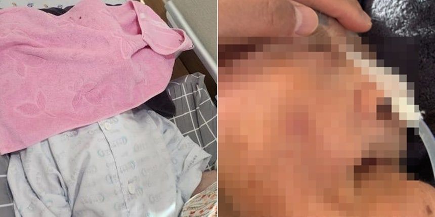 요양병원에 입원 중인 어머니의 얼굴에 누군가가 수건을 놓아 숨을 쉬지 못하는 장면을 봤다는 보호자의 사연이 알려졌다. 보배드림 캡처 