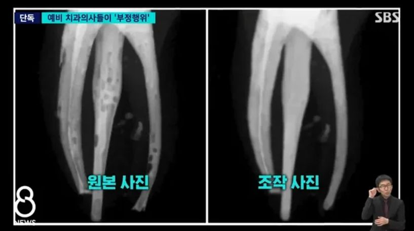 SBS 보도 화면 캡쳐