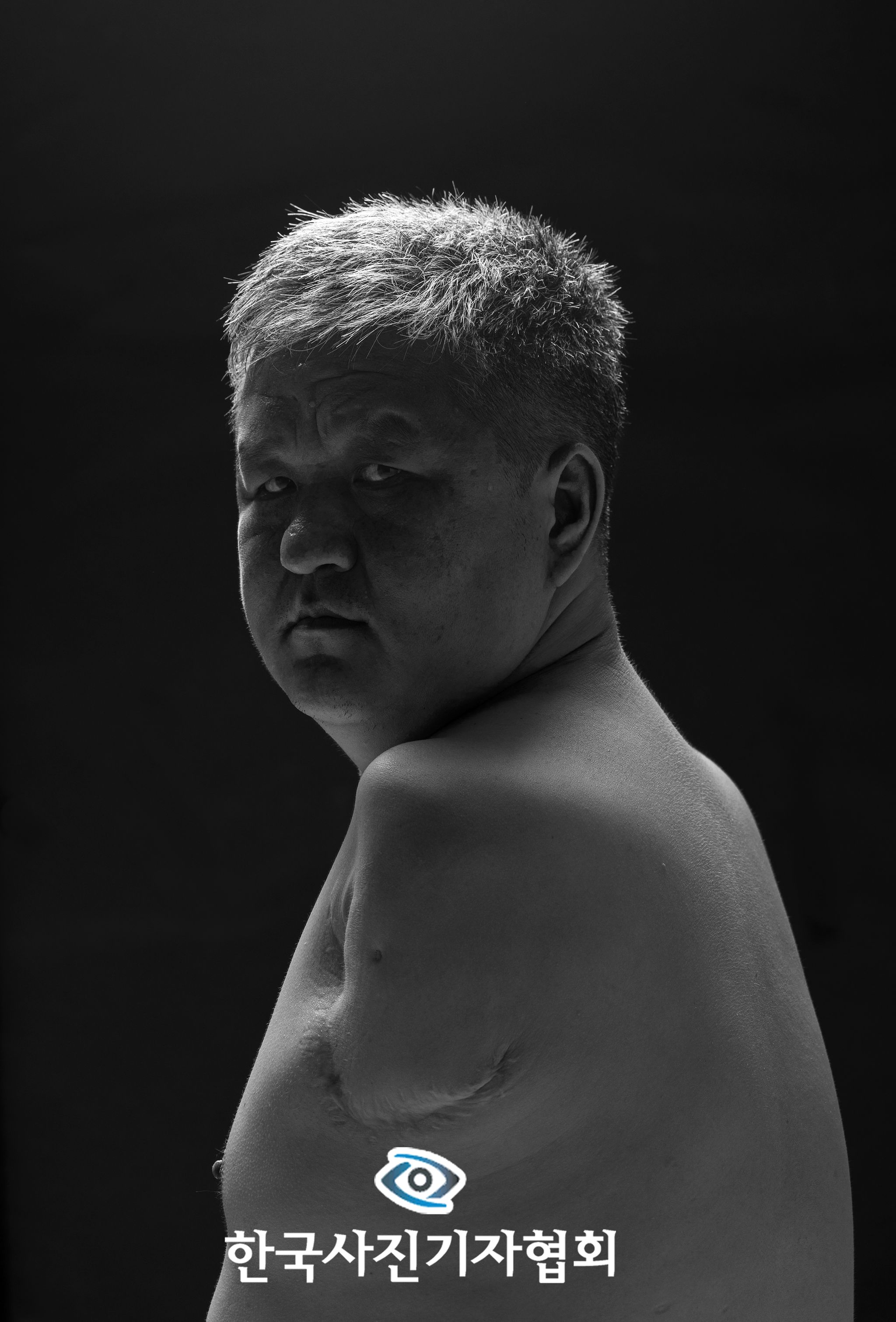 〈온몸으로 묻다 - 포트레이트 최우수상〉몸에 2만 볼트가 흐르는 중증화상 산재로 양팔을 절단한 몽골 출신 이주노동자 오기나씨가 카메라 앞에 서 묻는다. ″왜 아무도 책임지지 않죠?″ 한겨레21=김진수 기자