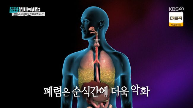 방송 화면 캡처