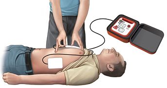 개정 지침의 자동심장충격기 패드(전극) 부착 위치. 사진 질병관리청