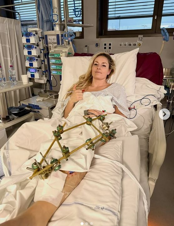 스키 여제 린지 본이 12일 인스타그램 계정에 3번째 수술 받은 자신의 모습을 전했다. 사진 린지 본 인스타그램