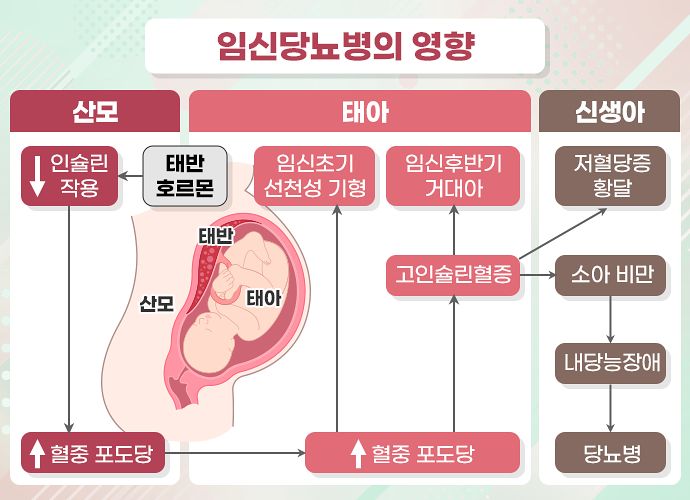 임신 당뇨병의 영향. 사진 질병관리청