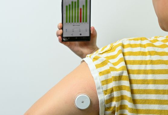 다이어트 목적으로 팔뚝에 연속혈당측정기를 달고 실시간 혈당 변화를 살피는 경우가 많다. 전문가들은 비 당뇨인은 연속혈당측정기를 지속적으로 사용할 필요가 없다고 조언한다. 사진 중앙포토DB 