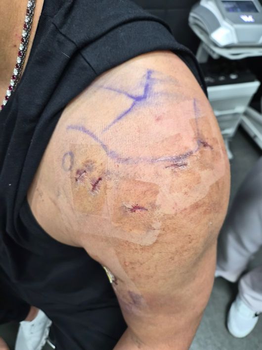 어깨 수술을 받은 추신수의 모습. / 노경은, 추신수 제공