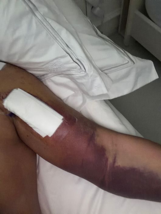 어깨 수술을 받은 추신수의 모습. / 노경은, 추신수 제공