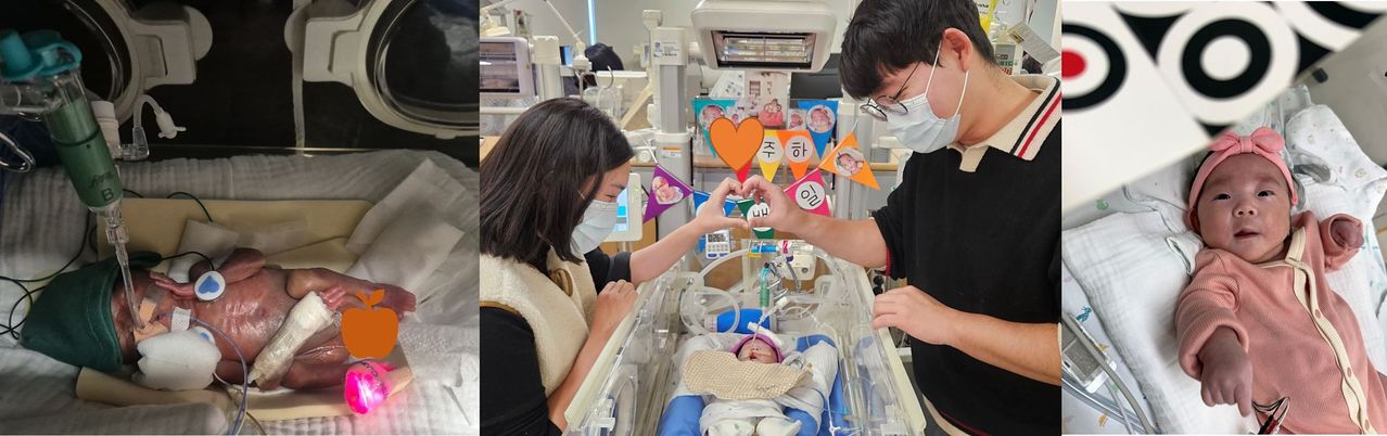 이른둥이 주하의 성장사진. (왼쪽부터) 지난해 9월 태어난 지 3일째, 지난해 12월 병실에서 맞은 백일사진, 올해 3월 퇴원 5일 전. 사진 서울성모병원