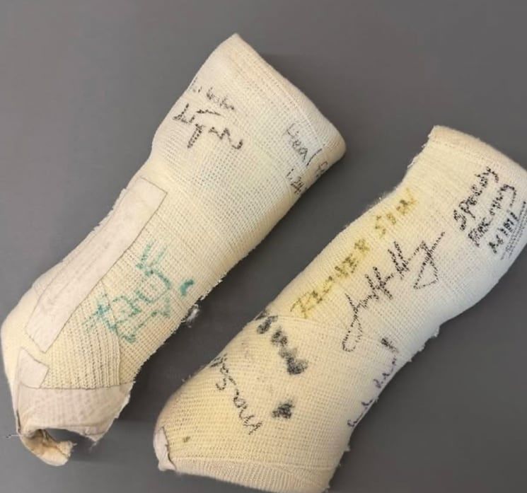 글로벌 빅테크 수장들의 메시지가 적힌 최태원 회장의 깁스. 사진 최태원 회장 인스타그램 캡처 