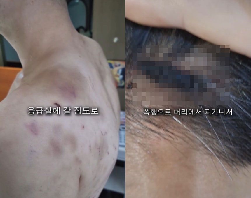 피해자 모습. 사진 SNS 캡처