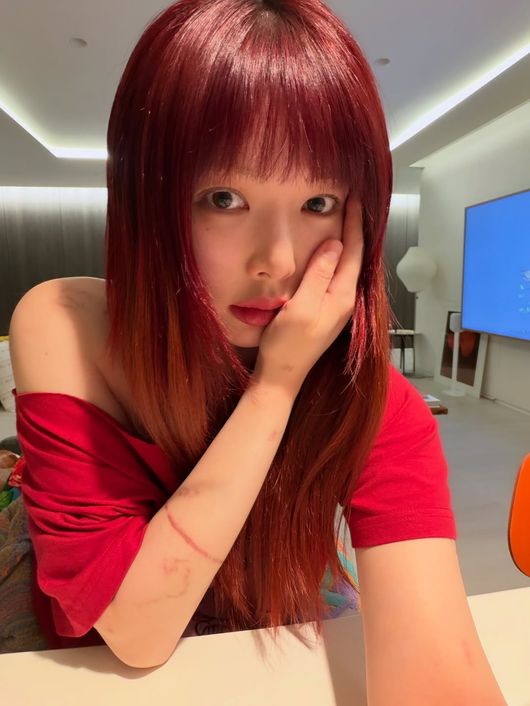 현아 SNS