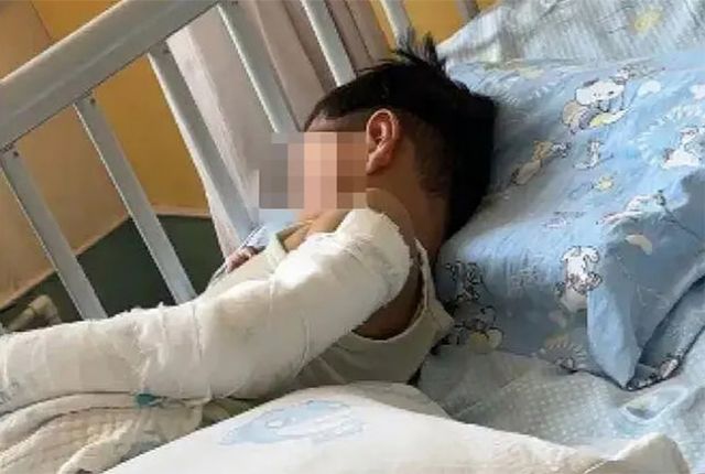 아파트 11층에서 추락한 뒤 집중 치료 끝에 생존한 4세 아이. 사진 SCMP 캡처