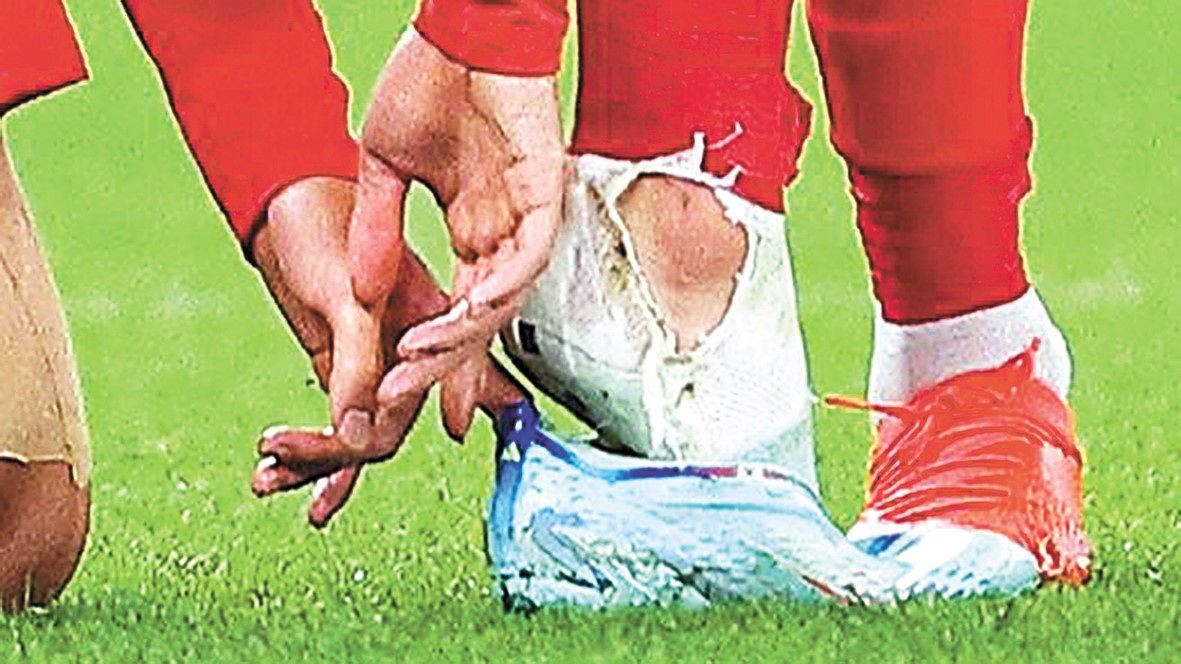 2022 카타르 월드컵 조별리그 H조 1차전 대한민국과 우루과이 경기. 대한민국의 손흥민이 우루과이의 카세레스의 거친 태클에 넘어진 뒤 축구화를 신고 있다. 손흥민의 오른쪽 양말이 찢겨져 있다. [연합뉴스]
