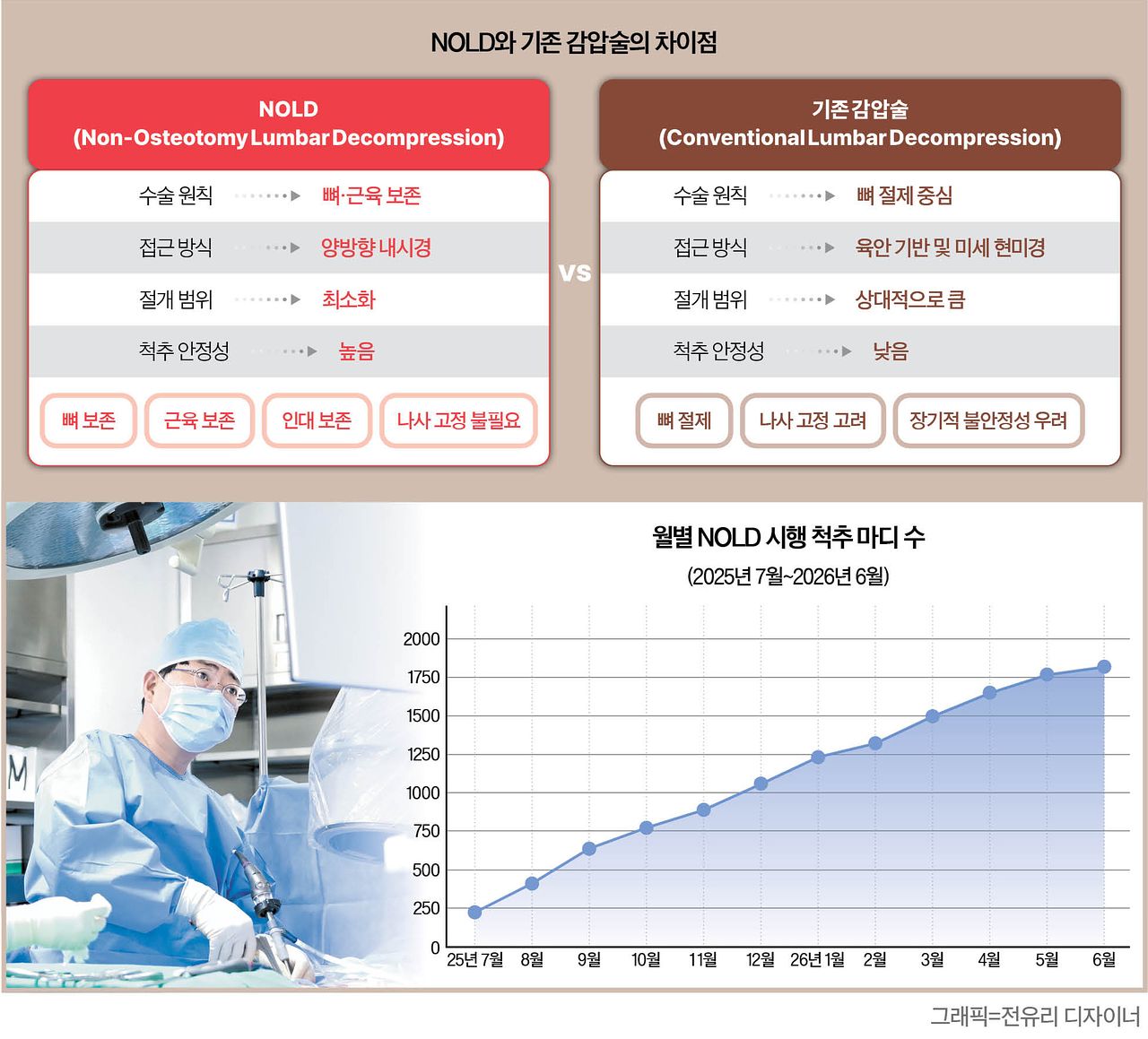 NOLD와 기존 감압술의 차이점