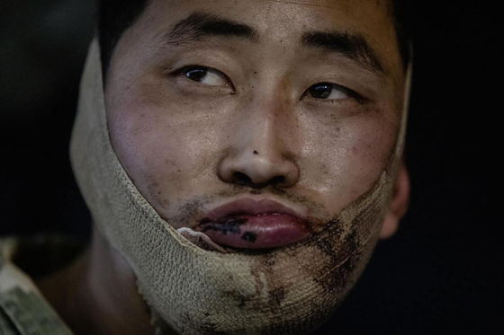 볼로디미르 젤렌스키 우크라이나 대통령은 지난해 1월 우크라이나군이 러시아 서부 쿠르스크 지역에서 북한 군인 2명을 생포했다고 밝혔다.   젤렌스키 대통령은 자신의 엑스(X)를 통해 글을 올려 생포된 북한 병사 2명이 다친 상태로 키이우로 이송됐으며 우크라이나 보안국(SBU)의 심문을 받고 있다고 전했다.   사진은 젤렌스키 대통령이 공개한 북한 군인. 뉴스1