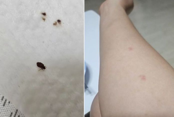 지난 10일 한 네티즌이 부산 영동구 찜질방을 방문한 뒤 집에서 빈대를 발견했다고 올린 사진. 사진 스레드 캡처