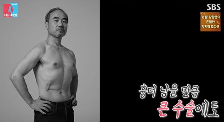 SBS 동상이몽