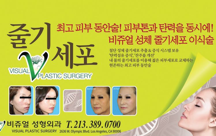 성체 줄기세포 이식술은 현존하는 최고 피부 동안술로 평가받는다.