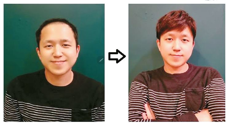 H 스캘프 & H 위그는 가볍고 자연스러운 맞춤가발을 커스텀 제작한다. 고객들의 취향에 맞춰 세련된 스타일의 가발을 제공한다.