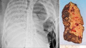 [Northwestern Medicine]