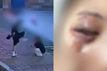 길에서 여친 얼굴 발로 찬 태권도 사범…그 뒤 보낸 섬뜩 사진