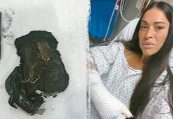 폭발한 보조배터리 잔해(왼쪽). 화상을 입은 애슐리 네벨. [인스타그램 캡처]