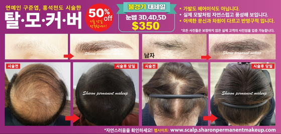 샤론 탈모커버 클리닉