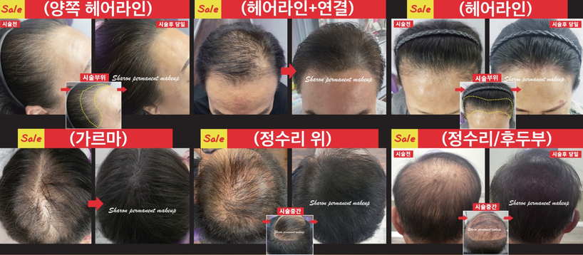 샤론 반영구 메이크업 & 탈모 커버 전문 클리닉