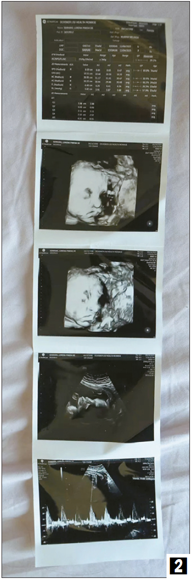 피네다가 구금 중 촬영된 자신의 태아 초음파 이미지. [칼라 가체트/LA타임스 객원기자]