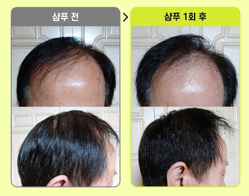 그래비티 헤어 리프팅 샴푸 엑스트라 스트롱